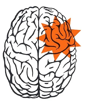 pregabalina 75 mg