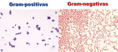 claritromicina suspensión